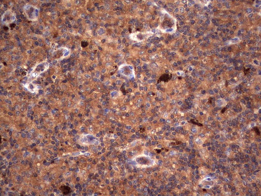 RSPO3 Antibody in Immunohistochemistry (Paraffin) (IHC (P))