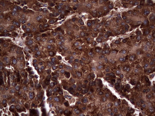 RSPO3 Antibody in Immunohistochemistry (Paraffin) (IHC (P))