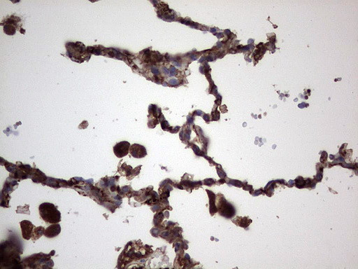 RSPO3 Antibody in Immunohistochemistry (Paraffin) (IHC (P))