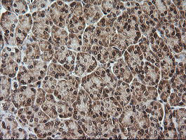 RTKN Antibody in Immunohistochemistry (Paraffin) (IHC (P))