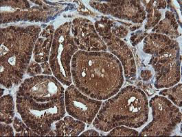 RTKN Antibody in Immunohistochemistry (Paraffin) (IHC (P))