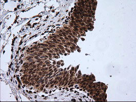 RTKN Antibody in Immunohistochemistry (Paraffin) (IHC (P))