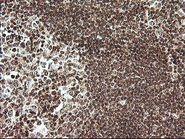 RTKN Antibody in Immunohistochemistry (Paraffin) (IHC (P))