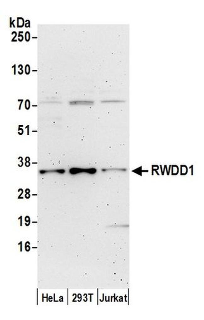 RWDD1 Antibody in Western Blot (WB)