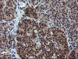 RYBP Antibody in Immunohistochemistry (Paraffin) (IHC (P))