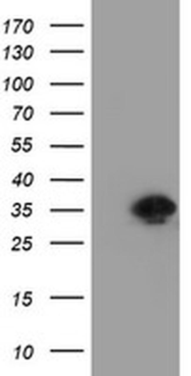 RYBP Antibody in Western Blot (WB)