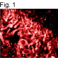 Ryanodine Receptor Antibody in Immunohistochemistry (IHC)