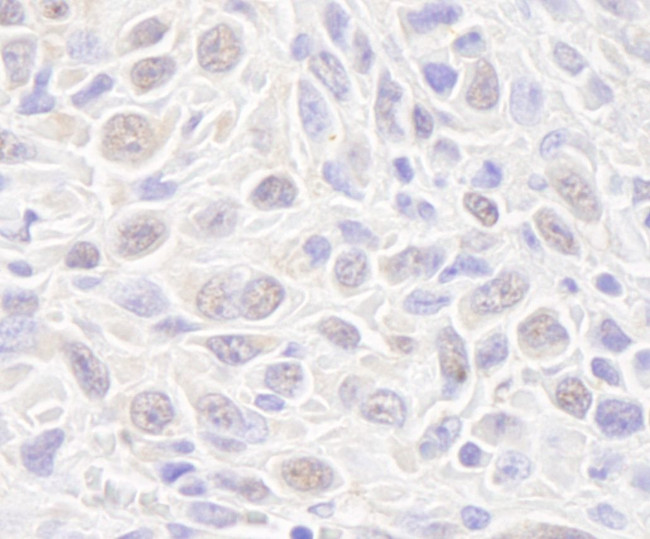 Rad50 Antibody in Immunohistochemistry (IHC)