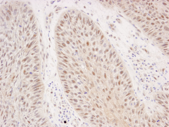 Rad50 Antibody in Immunohistochemistry (IHC)