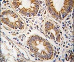 AHCY Antibody in Immunohistochemistry (IHC)