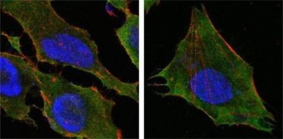 S100A10 Antibody in Immunocytochemistry (ICC/IF)