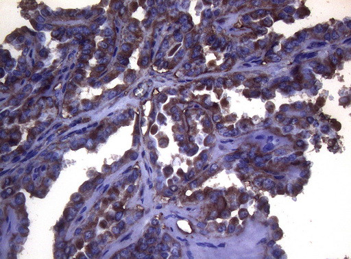 S100A9 Antibody in Immunohistochemistry (Paraffin) (IHC (P))