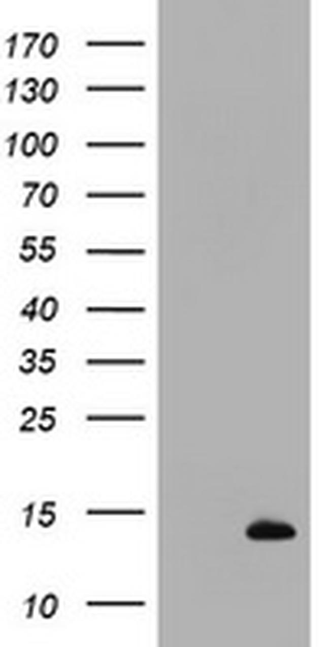 S100B Antibody in Western Blot (WB)