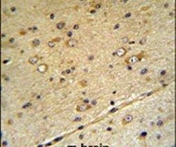 SLC39A3 Antibody in Immunohistochemistry (IHC)