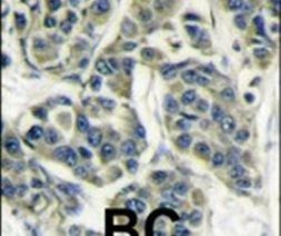 p70 S6 Kinase Antibody in Immunohistochemistry (IHC)