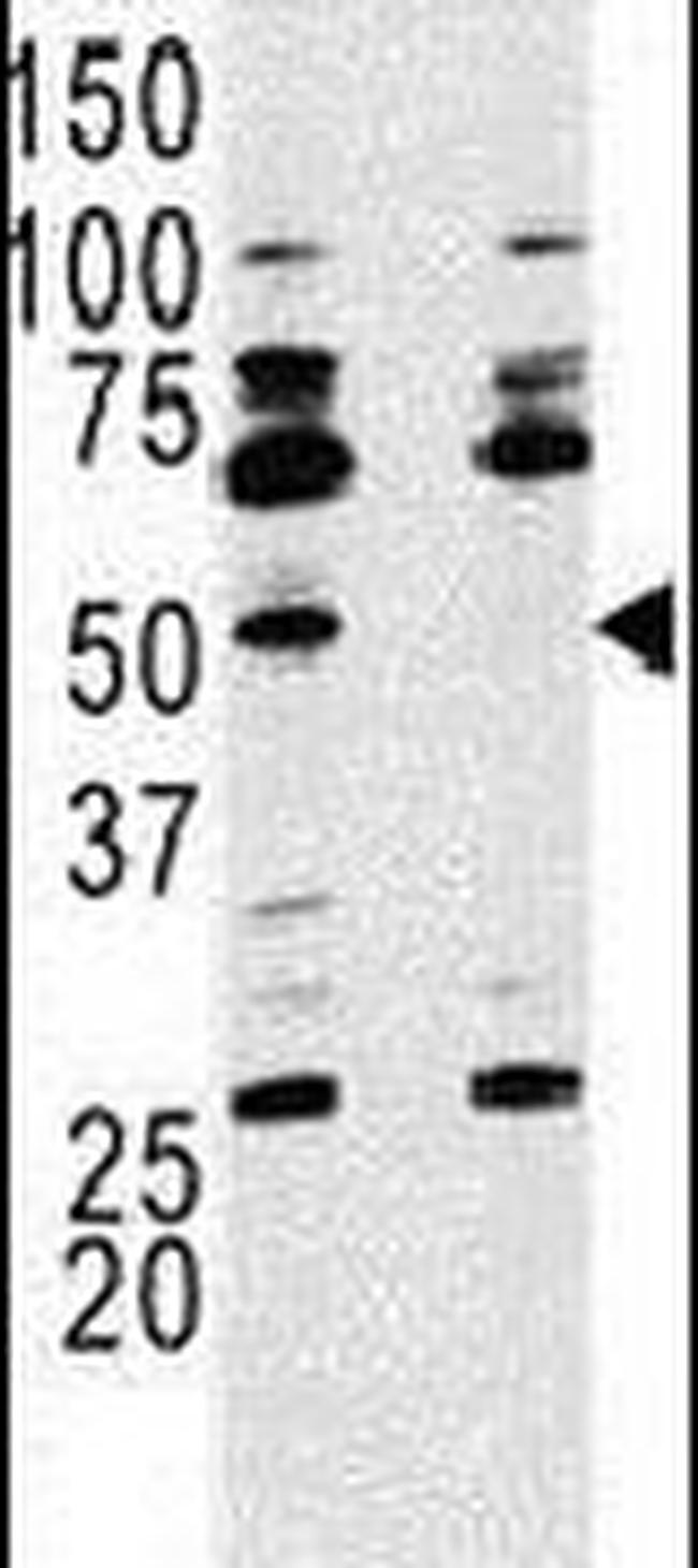 p70 S6 Kinase Antibody in Western Blot (WB)