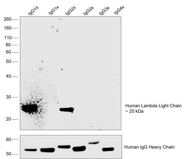 Human Lambda Light Chain Secondary Antibody in Western Blot (WB)