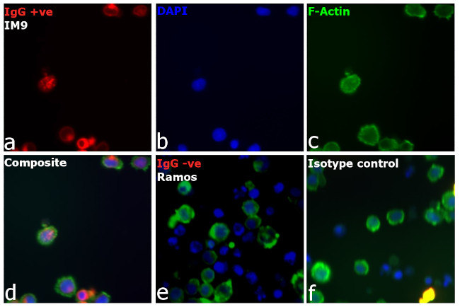 Human IgG (H+L) Cross-Adsorbed Secondary Antibody in Immunocytochemistry (ICC/IF)