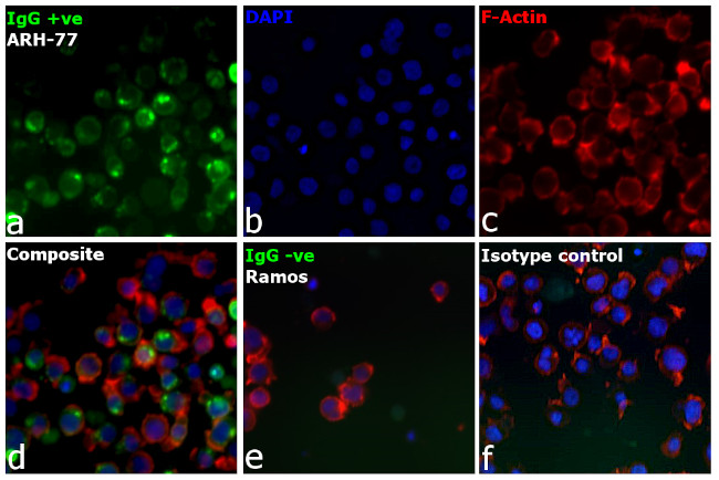 Human IgG Fc Cross-Adsorbed Secondary Antibody in Immunocytochemistry (ICC/IF)