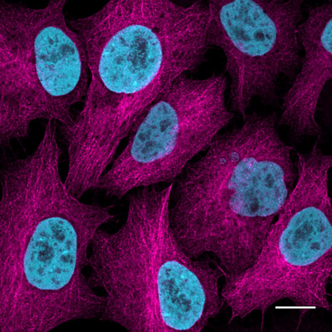 Rabbit IgG Nano (VHH) Secondary Antibody in Immunocytochemistry (ICC/IF)