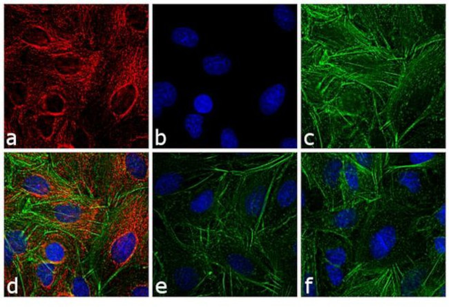 Rat IgG (H+L) Cross-Adsorbed Secondary Antibody in Immunocytochemistry (ICC/IF)