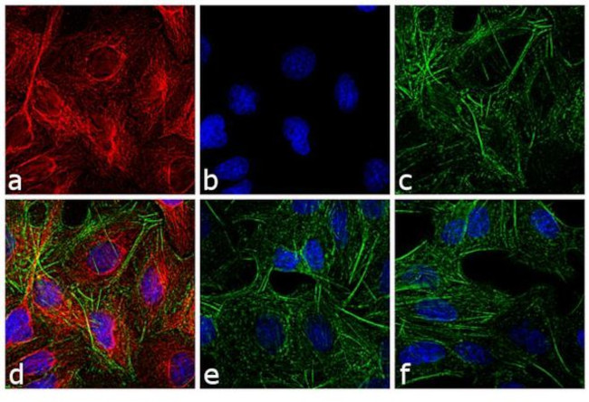 Rat IgG (H+L) Cross-Adsorbed Secondary Antibody in Immunocytochemistry (ICC/IF)