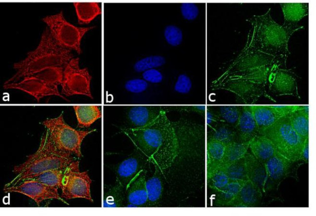 Mouse IgG (H+L) Cross-Adsorbed Secondary Antibody in Immunocytochemistry (ICC/IF)