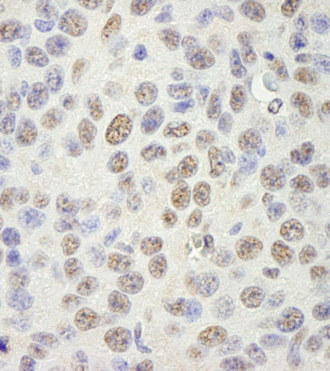 SAM68 Antibody in Immunohistochemistry (IHC)