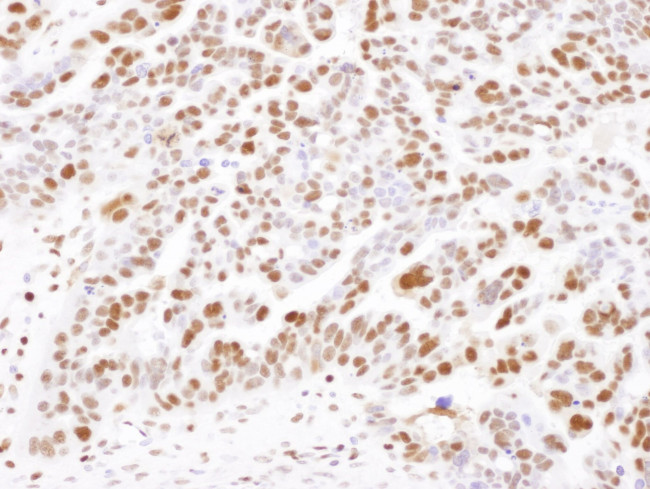 SAMHD1 Antibody in Immunohistochemistry (IHC)