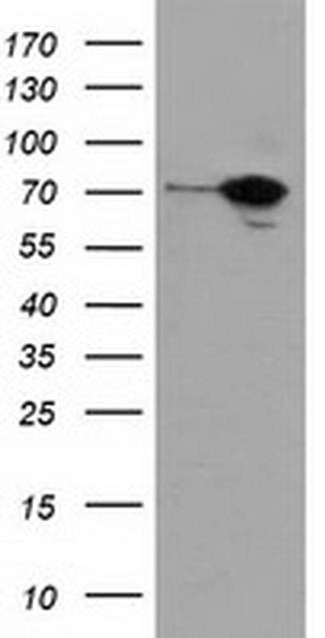 SAMHD1 Antibody in Western Blot (WB)