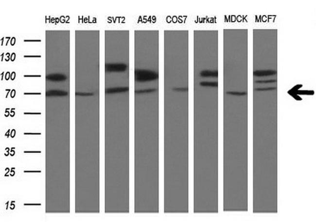 SAMHD1 Antibody in Western Blot (WB)