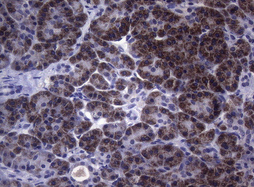 SAMSN1 Antibody in Immunohistochemistry (Paraffin) (IHC (P))