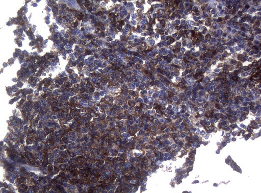 SAMSN1 Antibody in Immunohistochemistry (Paraffin) (IHC (P))