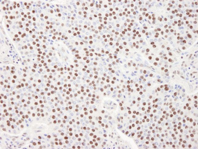 SART3/TIP110 Antibody in Immunohistochemistry (IHC)