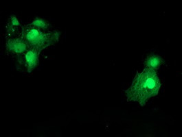 SAT2 Antibody in Immunocytochemistry (ICC/IF)