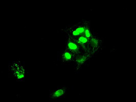 SATB1 Antibody in Immunocytochemistry (ICC/IF)