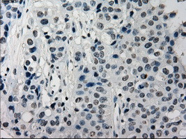 SATB1 Antibody in Immunohistochemistry (Paraffin) (IHC (P))