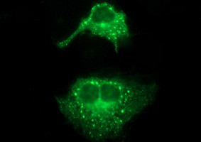 SCAMP2 Antibody in Immunocytochemistry (ICC/IF)