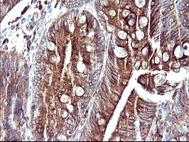 SCAMP2 Antibody in Immunohistochemistry (Paraffin) (IHC (P))