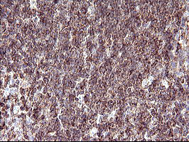 SCAMP2 Antibody in Immunohistochemistry (Paraffin) (IHC (P))