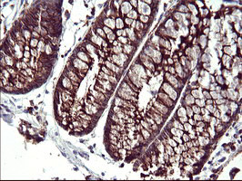 SCAMP2 Antibody in Immunohistochemistry (Paraffin) (IHC (P))