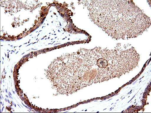 SCAMP2 Antibody in Immunohistochemistry (Paraffin) (IHC (P))