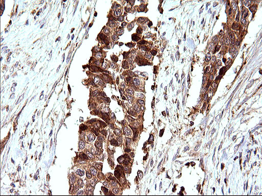 SCAMP2 Antibody in Immunohistochemistry (Paraffin) (IHC (P))