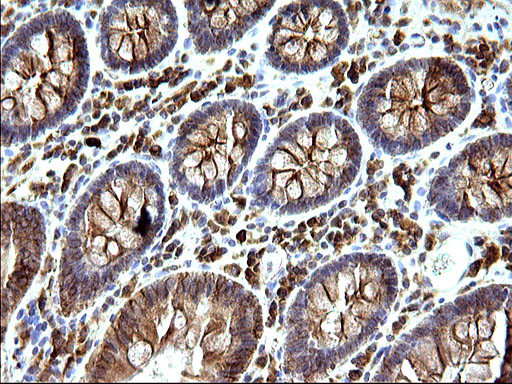 SCAMP2 Antibody in Immunohistochemistry (Paraffin) (IHC (P))