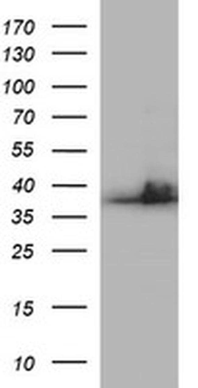 SCAMP2 Antibody in Western Blot (WB)