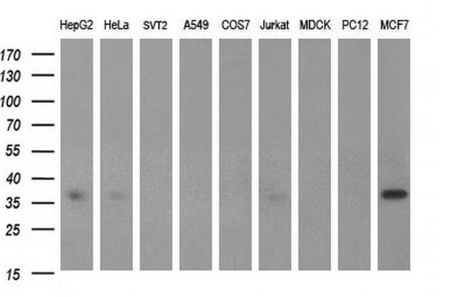 SCAMP2 Antibody in Western Blot (WB)