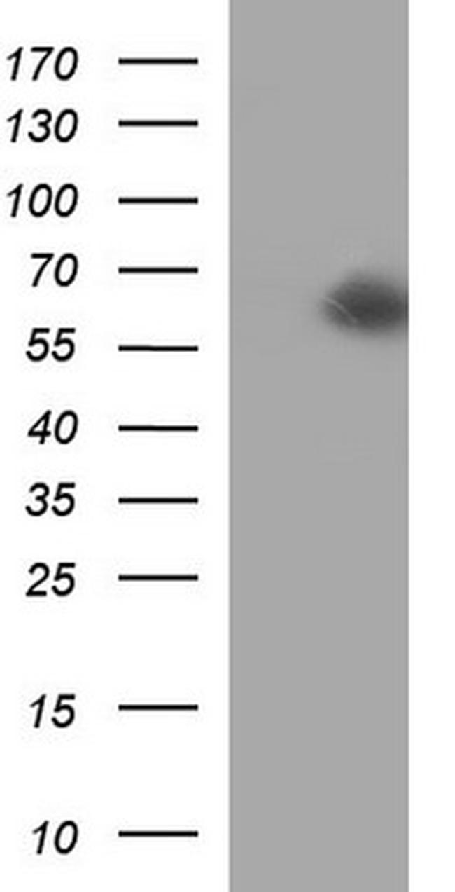 SCARB1 Antibody in Western Blot (WB)