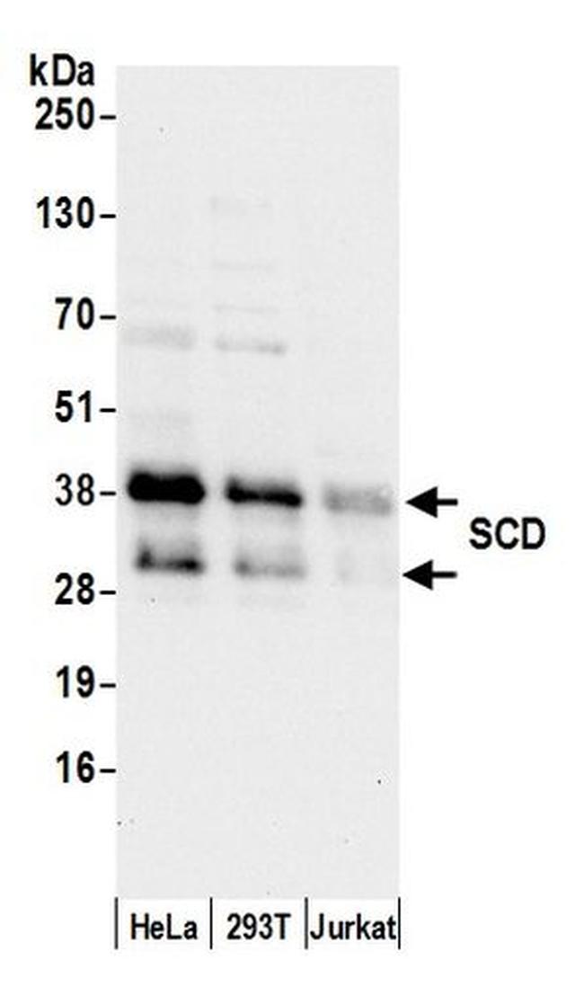 SCD/SCD1/Stearoyl-CoA Desaturase Antibody in Western Blot (WB)