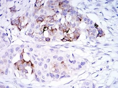 Mammaglobin A Antibody in Immunohistochemistry (Paraffin) (IHC (P))