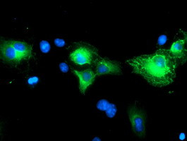 SCHIP1 Antibody in Immunocytochemistry (ICC/IF)